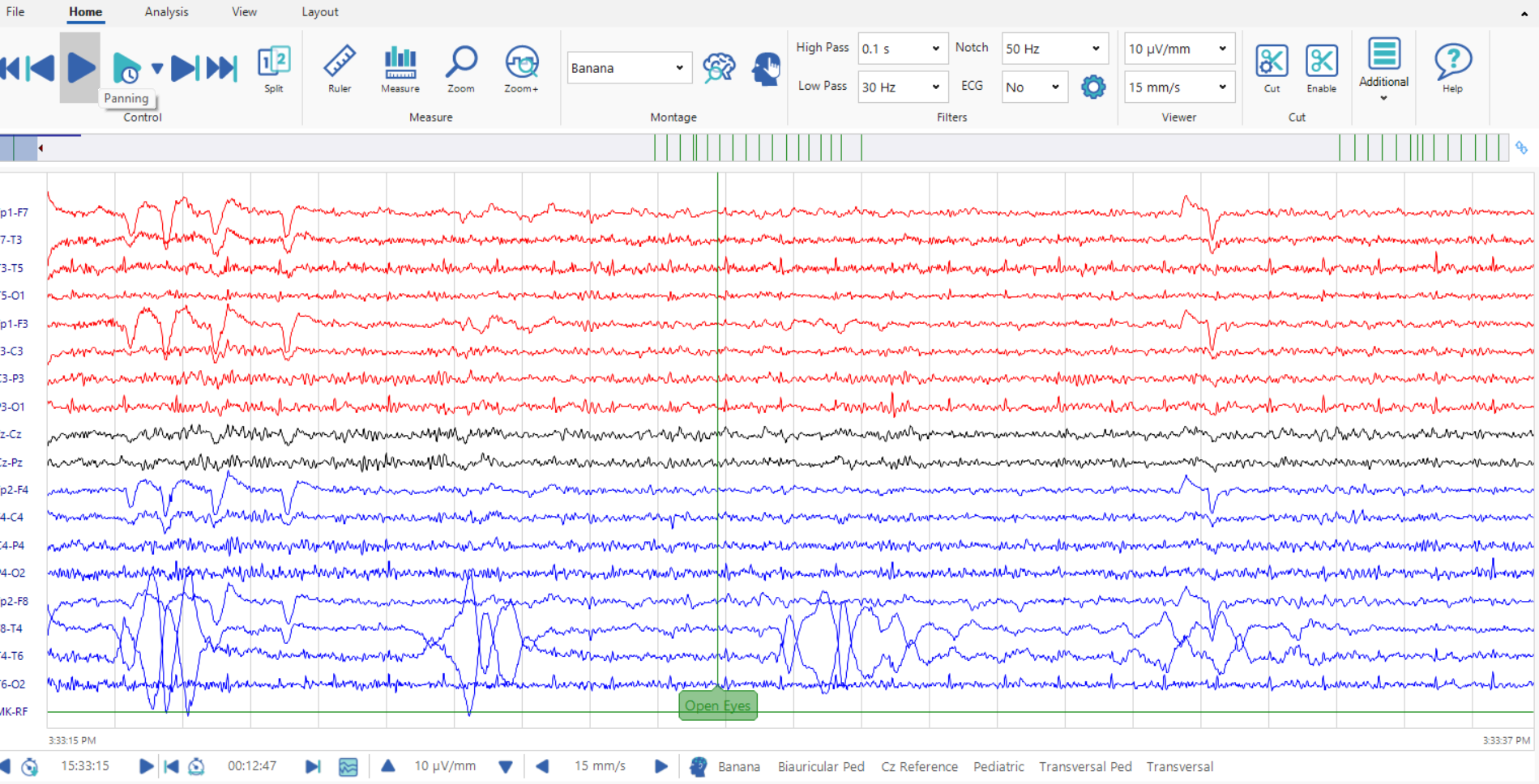 Neurotravel Light acquisition software displaying captured multi-channel EEG waveforms
