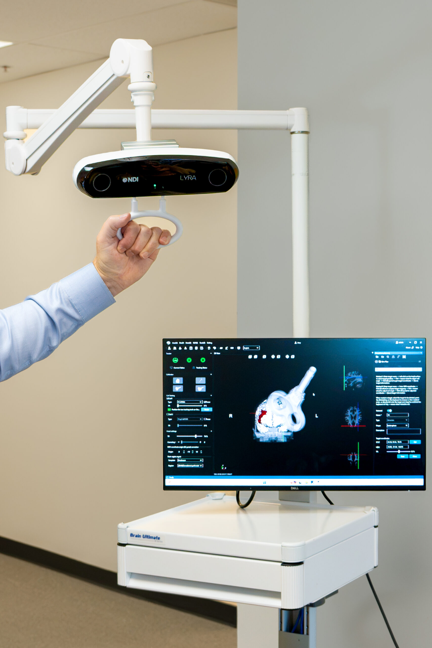 A clinician adjusts the overhead optical tracking camera on its articulated arm, with the neuronavigation software displayed on the monitor below.
