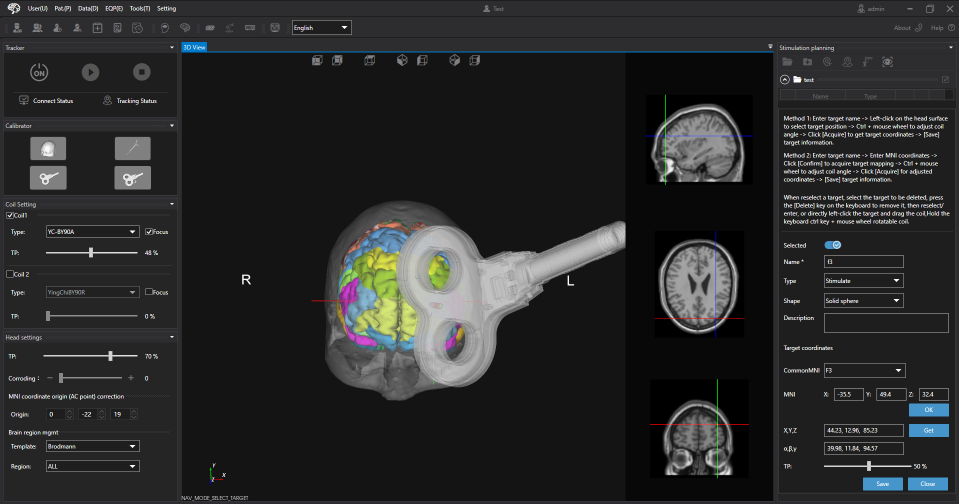The target creation panel open beside the 3D view, with the treatment coil positioned over the cortical parcellation.