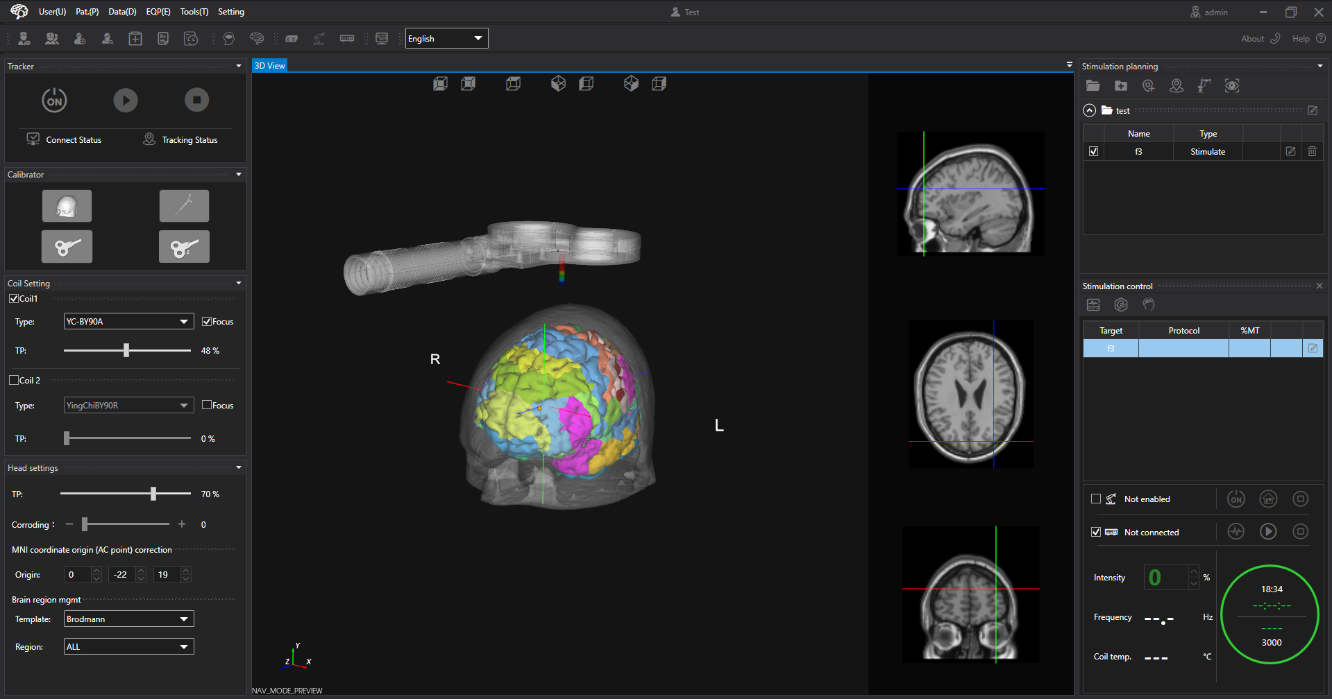 A patient's cortical parcellation displayed beneath a translucent scalp in the 3D view, with the tracked treatment coil positioned above it.